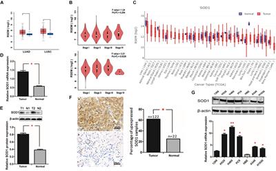 SOD1 Promotes Cell Proliferation and Metastasis in Non-small Cell Lung Cancer via an miR-409-3p/SOD1/SETDB1 Epigenetic Regulatory Feedforward Loop